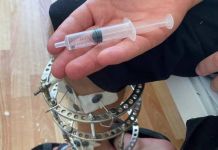 В Пензе врачи извлекли из пациента осколок кассетного снаряда