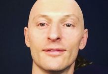 Павел Воля стал лысым 