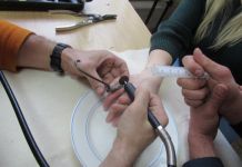 Спасатели помогли женщине снять с пальца кольцо