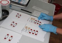 Главный инфекционист региона проведет прием больных гепатитом