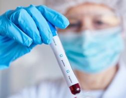 ﻿Бессимптомное течение COVID-19 связали с проблемной работой иммунитета 