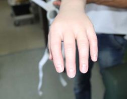 Пензячка получит индивидуальный протез за 1,5 миллиона рублей