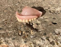 В Пензе возле отделения почты нашли зубы
