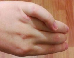 Пенсионерка сломала палец молодой маме