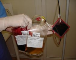 В Пензе в отношении главврача станции переливания крови возбуждено уголовное дело