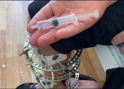 В Пензе врачи извлекли из пациента осколок кассетного снаряда